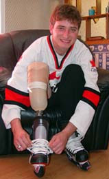 Patient, Eric Watson, below the knee amputee, member 2005 Canadian Amputee Hockey Team